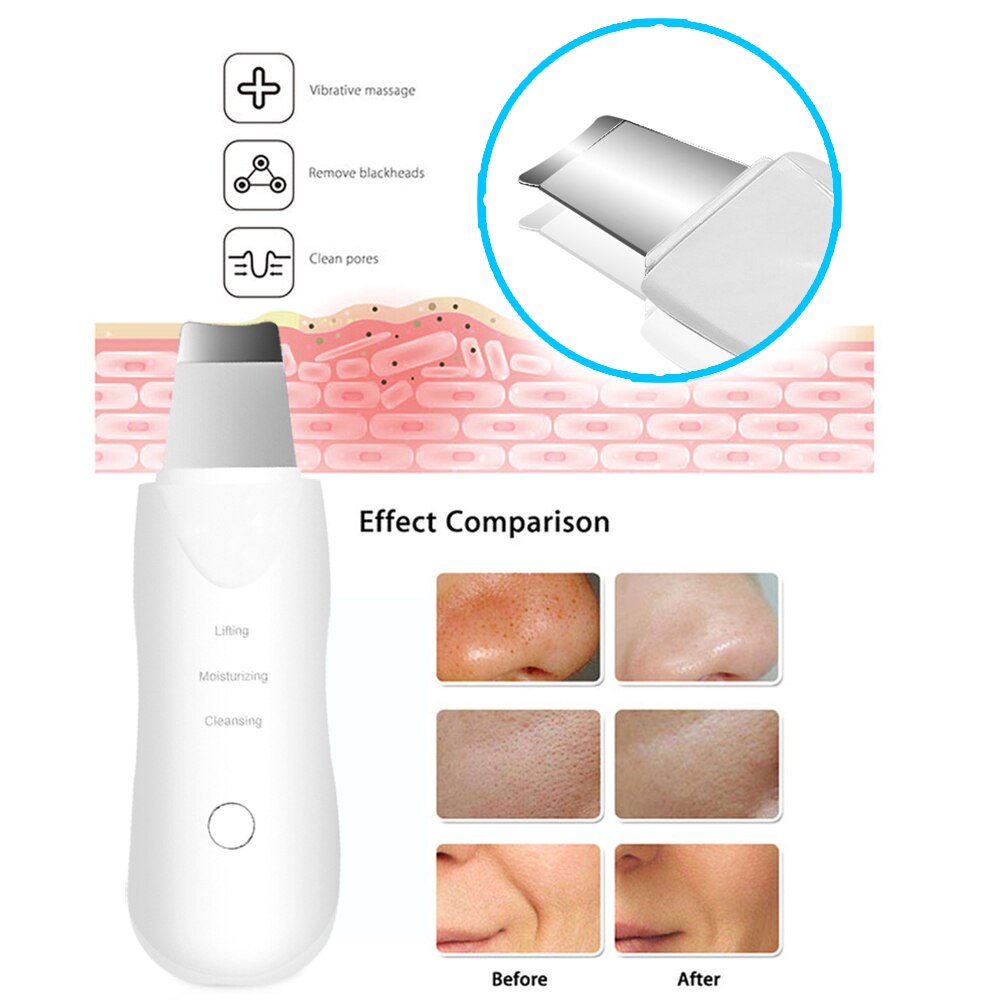 Ultrasonic Cleane Beauty Device Devices Peeling Cavitation Professional Skin Cleansing Face Care Rejuvenating Ultrasonic Cleaner