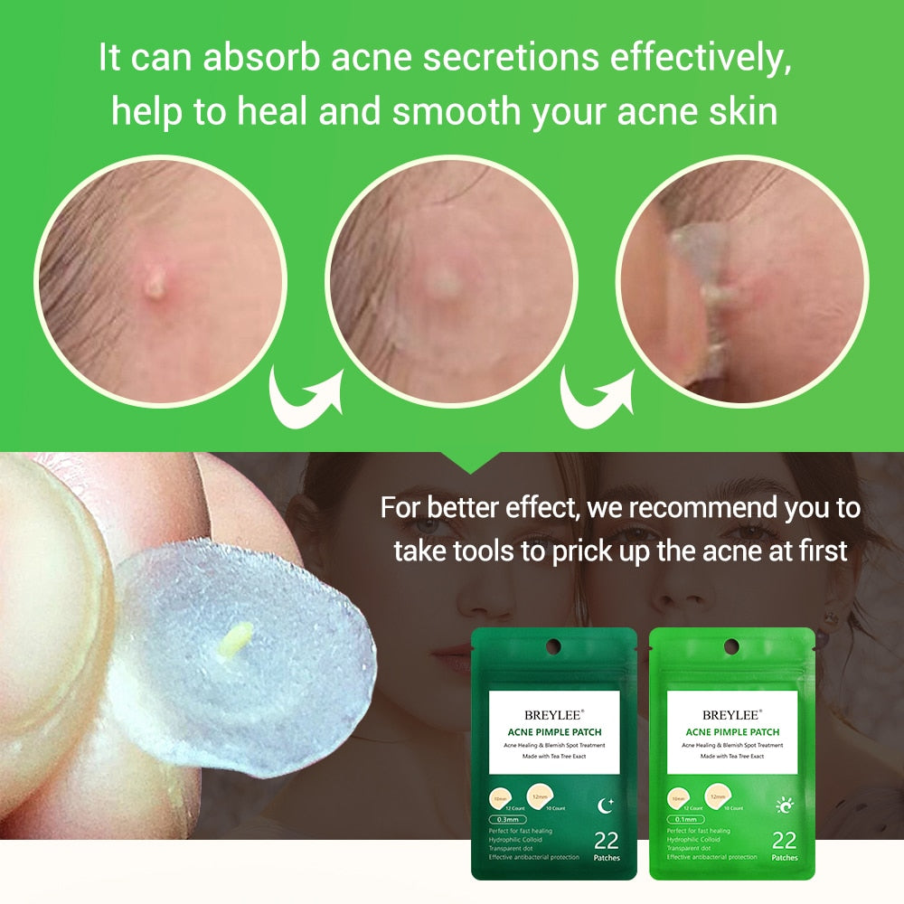 BREYLEE Acne Pimple Patch Acne Treatment Serum Face Sheet Mask Facial Acne Cream Essence Facial Skin Care Pimple Remover Tools