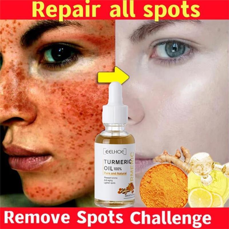 10PCS Whitening Freckle Serum Brighten Remove Dark Spot Fade Pigment Melanin Correcting Facial Essence Skin Care Korea Comestic