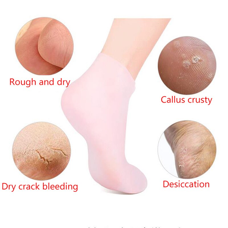 1Pair Feet Care Socks Spa Home Use New Silicone Moisturizing Gel Heel Socks Cracked Foot Skin Care Protectors Anti Cracking