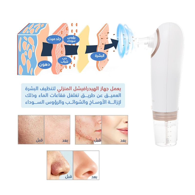 Electric Facial Cleaning Blackhead Remover Small Bubble Vacuum Cleaner Blackhead Acne Remover Shrink Pore Hydrating Pore Cleaner