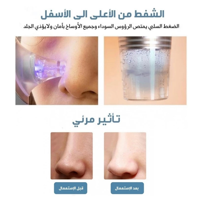 Electric Facial Cleaning Blackhead Remover Small Bubble Vacuum Cleaner Blackhead Acne Remover Shrink Pore Hydrating Pore Cleaner