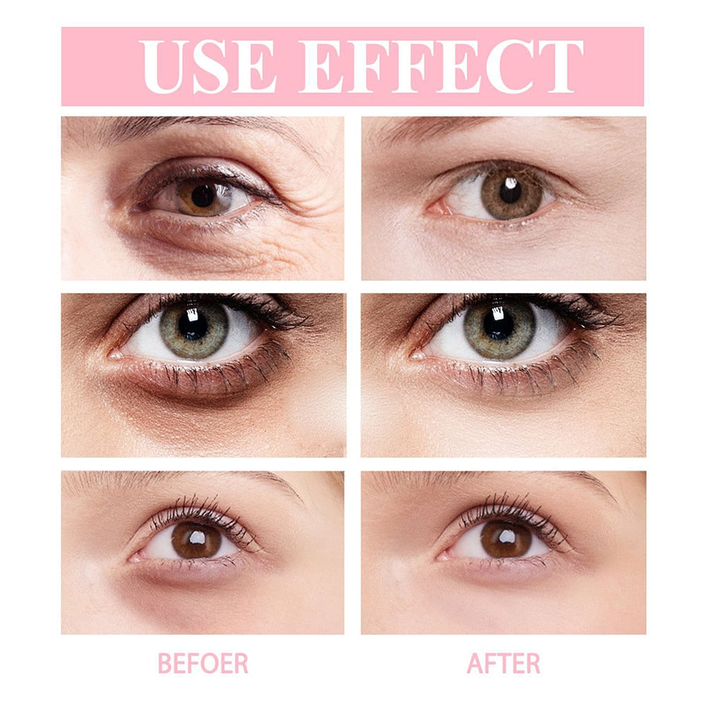 Nti-Wrinkle Eye Cream Wrinkle Removing Dark Circles Lightening Fine Lines Moisturizing Whitening Skin Care Eye Bag Stick 2023