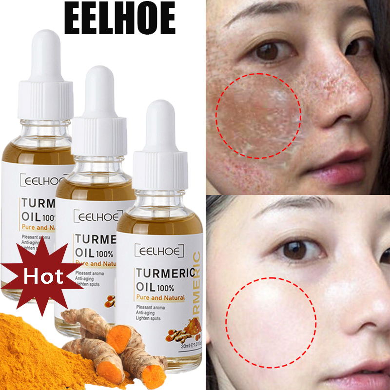 10PCS Whitening Freckle Serum Brighten Remove Dark Spot Fade Pigment Melanin Correcting Facial Essence Skin Care Korea Comestic