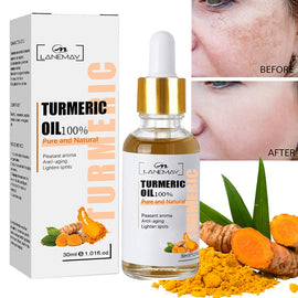 Turmeric Freckle Whitening Serum Fade Dark Spot Removal Pigment Melanin Correcting Facial Essence Beauty Face Skin Care 30ml